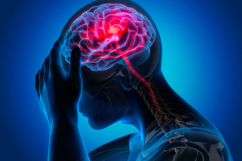 biến chứng đau nửa đầu migraine