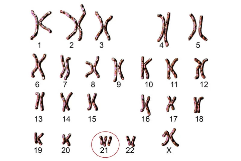 nhiễm sắc thể 21