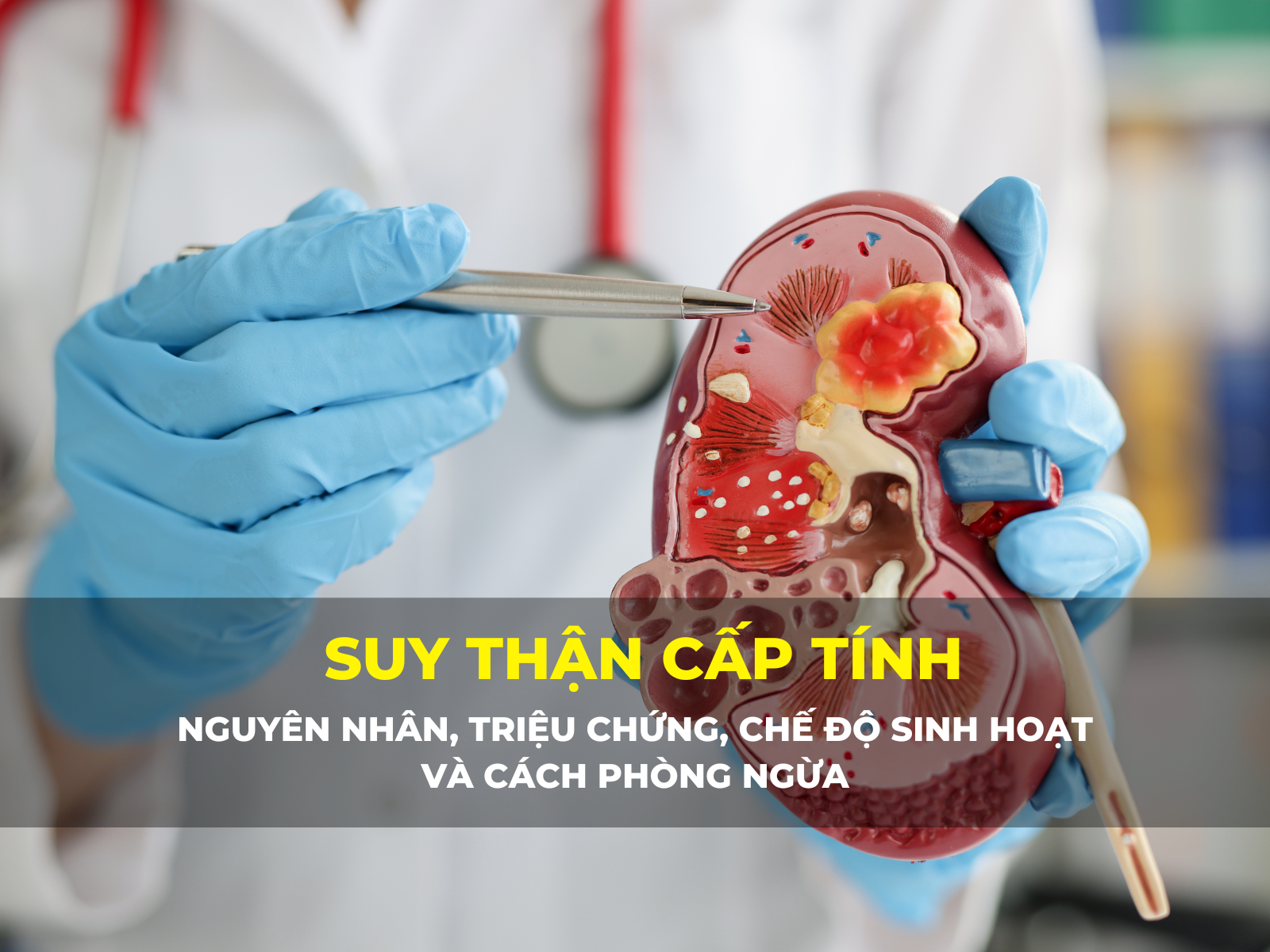 suy thận cấp tính