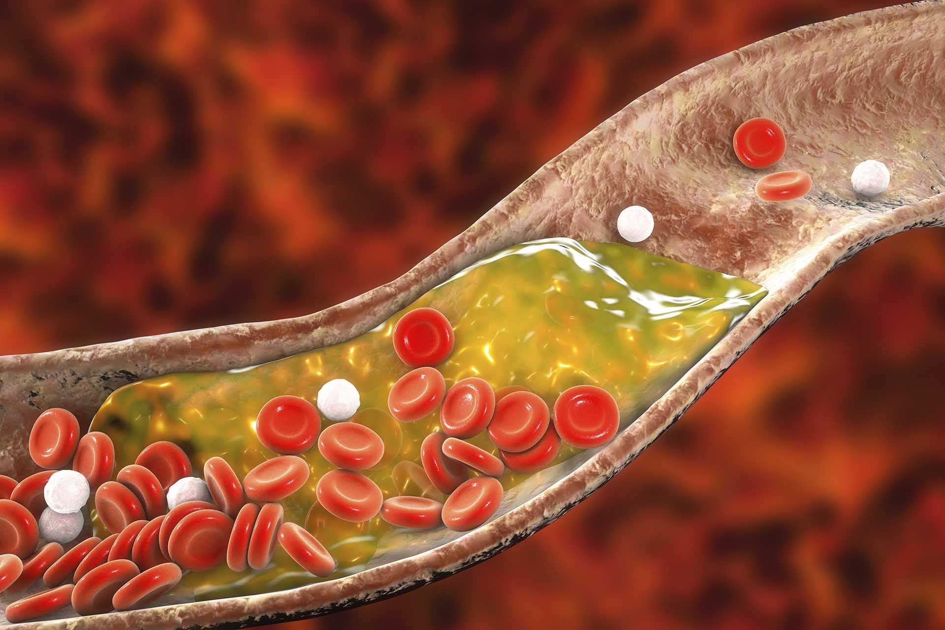 Cholesterol