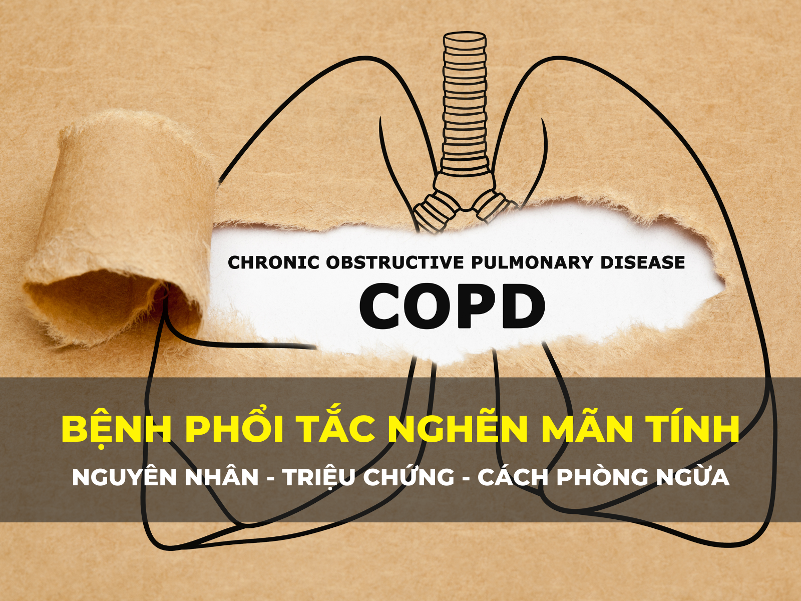 bệnh phổi tắc nghẽn mãn tính