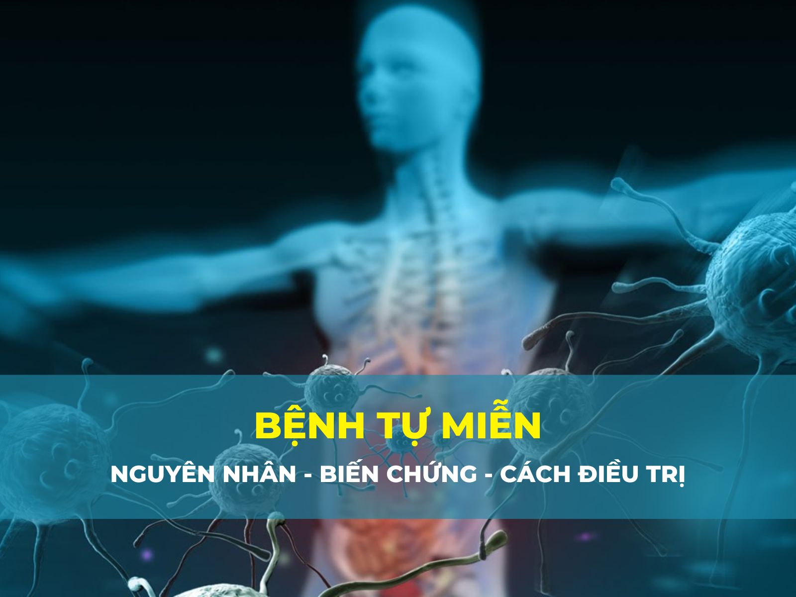 bệnh tự miễn