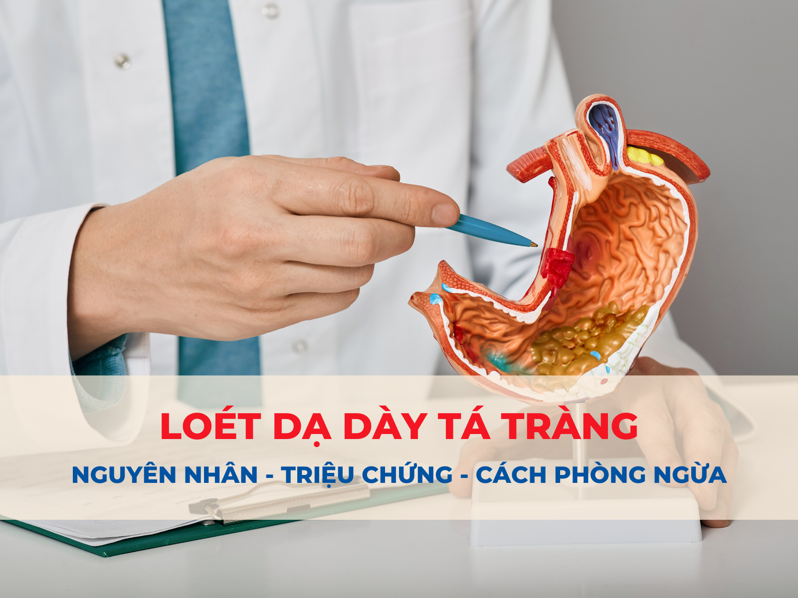 loét dạ dày tá tràng