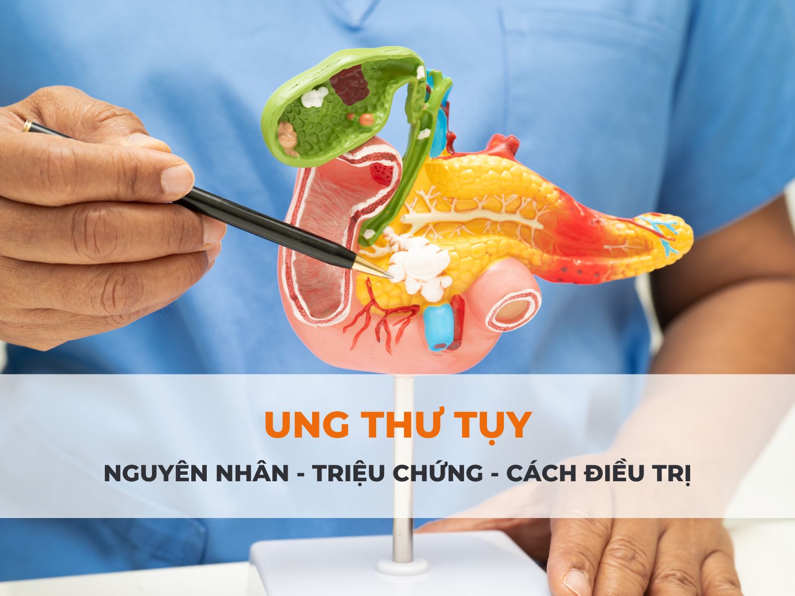 ung thư tụy