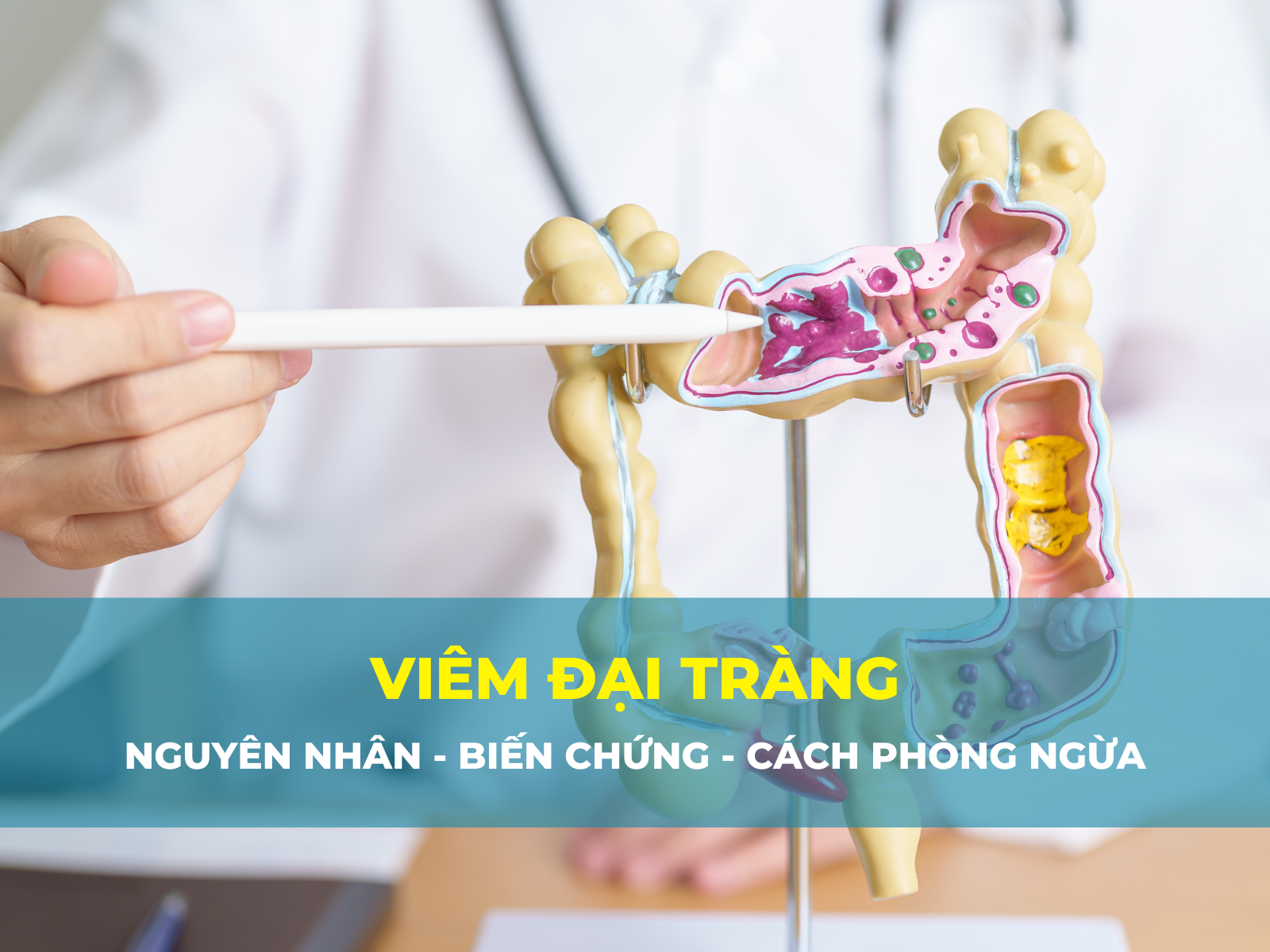 viêm đại tràng